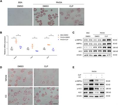 Clopidogrel ameliorates high-fat diet-induced hepatic steatosis in mice through activation of the AMPK signaling pathway and beyond